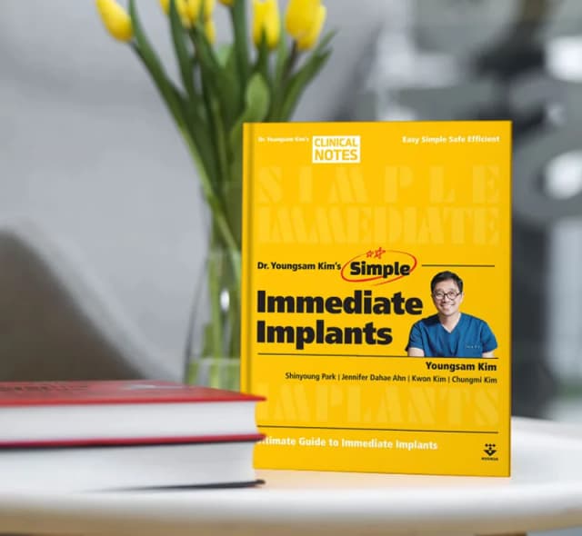 Simple Immediate Implants
