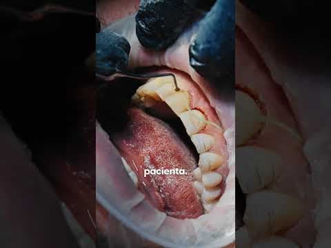 Příběh 3 - Nový Úsměv The Clinic