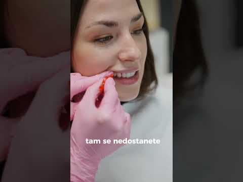 Otázky našich pacientů