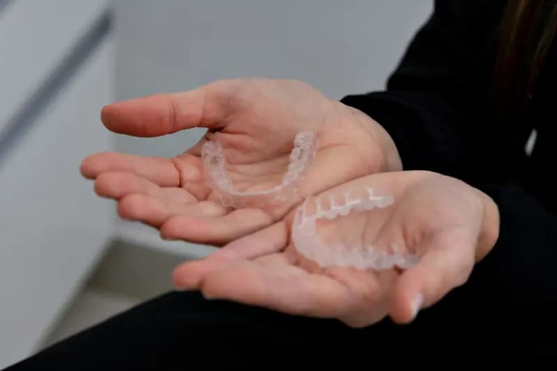 Křivé zuby trápí až 80 % Čechů
