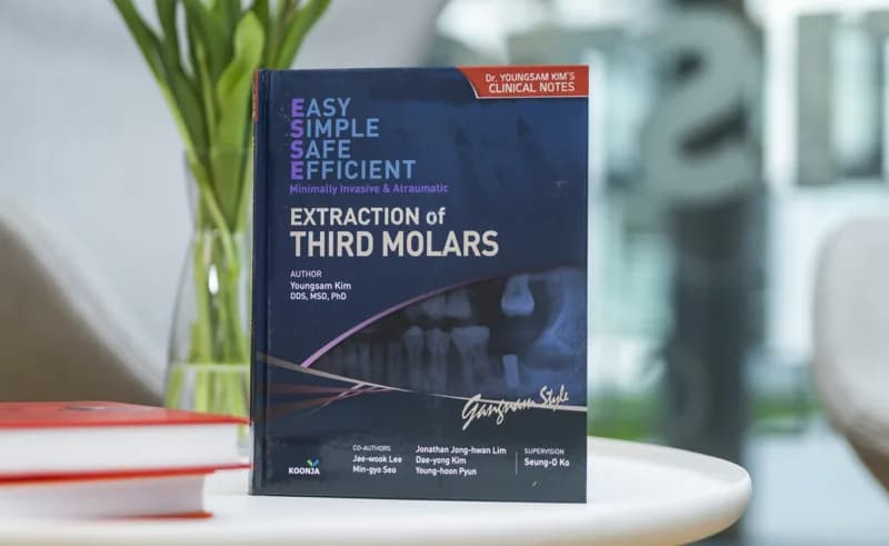 Extraction of Third Molars