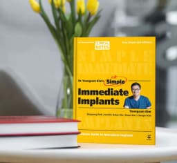 Simple Immediate Implants